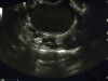 자궁·난소 초음파 검사, 2020년부터 건강보험 적용