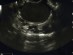 자궁·난소 초음파 검사, 2020년부터 건강보험 적용